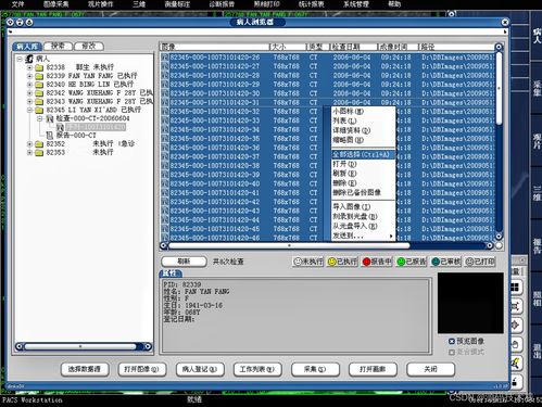 醫(yī)學(xué)影像信息系統(tǒng)(PACS)源碼基礎(chǔ)解析 架構(gòu)、原理與數(shù)據(jù)處理服務(wù)